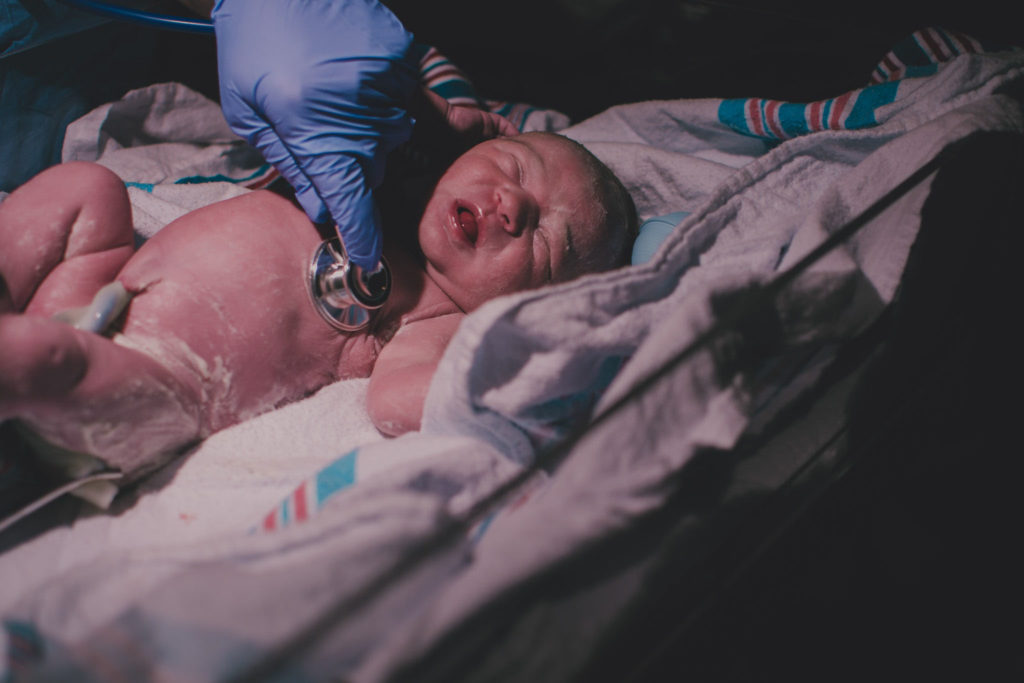 Newborn baby girl getting her vitals taken, shortly after being born.